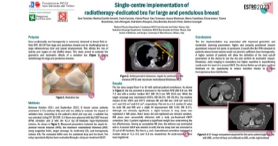 Monza ESTRO 2023 poster thumbnail